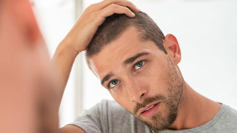 Masalah Rambut Gugur.